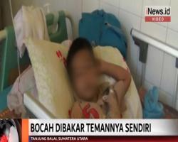 Bocah di Tanjung Balai Dipaksa Minum Air Seni dan Dibakar Temannya