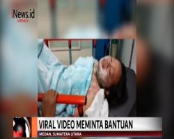 Dibakar Pacar, Mahasiswi Minta Bantuan Biaya Pengobatan di Medsos