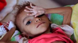 Miris, 85.000 Anak Yaman Mati Kelaparan akibat Perang