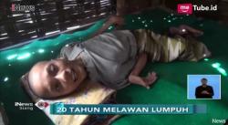 Pemuda di Jombang Terbaring Lemah Melawan Lumpuh Selama 20 Tahun