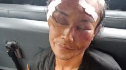 Diduga Hendak Memerkosa Wanita, Orang Gila Ini Dipukuli Warga