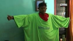 Kisah Bocah Obesitas di Karawang Turunkan Berat Badan hingga 100 Kg