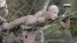 Manusia Serigala hingga Mirip Macan Tutul, Begini Kehidupan 6 Orang Unik di Dunia