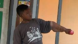 Arya Permana Bocah Seberat 192 Kg, Begini Kondisinya Sekarang