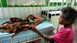 RSUD Kota Soe Rawat 8 Pasien Gizi Buruk<