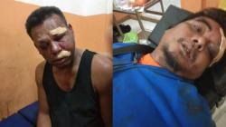 Rebutan PSK, Oknum TNI dan Wartawan Baku Hantam hingga Babak Belur