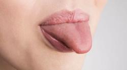 Ayo, Kenali Covid Tounge Gejala Baru Covid-19 