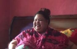 Begini Kondisi Terkini Titi Wati Pengidap Obesitas asal Palangkaraya