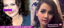 Wajah 5 Artis Ini Berubah Drastis Sebelum dan Sesudah Operasi Plastik