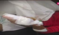 Cekcok, Suami di Pontianak Tebas Tangan Istri hingga Putus