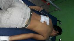 Gara-Gara Geber Motor, Pemotor Ditikam Pengemudi Mobil di Medan