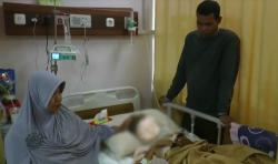 Kena Petasan, Wajah Bocah SD di Kampar Riau Luka Bakar Serius dan Dioperasi