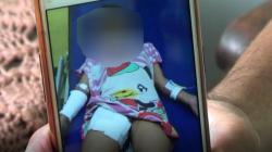 Dianiaya Ibu Angkat, Bocah Perempuan Yatim Piatu di Depok Kondisinya Mengenaskan