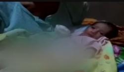 Video Bayi dengan Dinding Perut Tergantung Keluar Tubuh di Lampung Butuh Bantuan