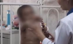 Video Balita di Samarinda Dianiaya Pengasuh hingga Mengalami Patah Tulang