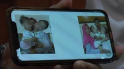 70 Dokter Tangani Operasi Bayi Kembar Siam Akila dan Azila di RSUD dr Soetomo