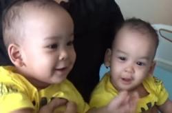 Begini Kondisi Bayi Kembar Siam Adam dan Malik Pascaoperasi Pemisahan di Medan