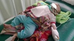 Bayi di Banyuasin Meninggal Dunia Terdampak Kabut Asap Kebakaran Hutan