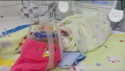 Bayi Lahir Prematur, Bibir Sumbing dan Berkelamin Ganda di Sumbawa Perlu Uluran Tangan