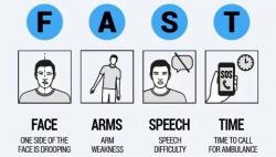 Tanda-Tanda Stroke, Perhatikan 3 Gejala Ini di Tubuh Anda