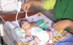 Video Bayi Lahir Tidak Sempurna di Mandailing Natal Diduga Terpapar Merkuri