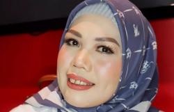 Elly Sugigi Operasi Gigi, Netizen: Mpok, Cantik Banget