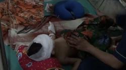 Gigit 1 Keluarga, Anjing Gila yang Berkeliaran di Lebongnge Bone Dibunuh Warga