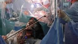 Pasien Ini Diminta Bermain Biola saat Jalani Operasi Pengangkatan Tumor