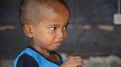 Cerita Pilu Kakak Adik di Tapanuli Selatan yang Jadi Pemakan Sabun Cuci