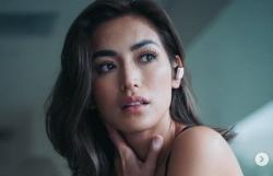 Ayah Jessica Iskandar Jadi Korban Tabrak Lari hingga Patah Tulang