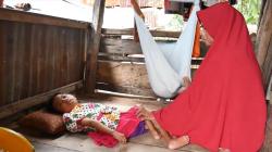 Bocah Usia 8 Tahun di Barru Menderita Lumpuh Layu sejak Usia 17 Bulan