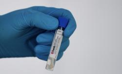 5 Biarawati Indonesia yang Tinggal di Italia Terinfeksi Virus Corona