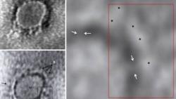 Ini Penampakan Virus Corona yang Diabadikan Ilmuwan India