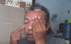 Video Warga di Surabaya Rabun Mata akibat Tersemprot Disinfektan