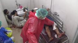 Polisi Tembak 3 Buruh Bangunan di Makassar karena Alih Profesi Jadi Perampok