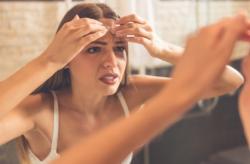 Bukan Cuma Keriput Ternyata Ini Musuh Utama Para Perempuan, Salah Satunya Jerawat