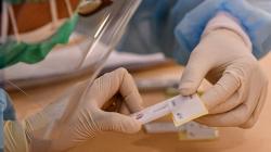 RSD Pulau Galang Rawat 17 Pasien Positif Corona, 6 Jamaah Tabligh dari India