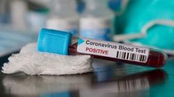  Update Covid-19 DIY per 13 Mei: 181 Positif, 68 Sembuh dan 7 Meninggal