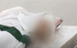 Video Perempuan di Sukabumi Dibakar Hidup-Hidup, Korban Tewas Luka Bakar 90 Persen