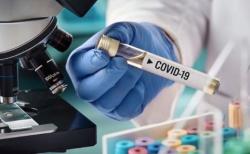 Pasien Positif Covid-19 di Indonesia Masih Bertambah, Ini Penyebabnya