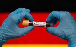 650 Kasus Baru Covid-19 Muncul di Jerman dari Cluster Rumah Potong Hewan