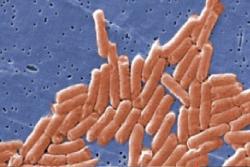 Kasus Covid-19 Masih Tinggi, Lebih dari 400 Orang di AS Malah Terinfeksi Salmonella