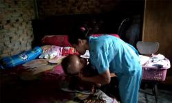 13 Tahun Derita Hidrosefalus, Anak di Padang Pariaman Ini Juga Idap Penyakit Hati dan TBC