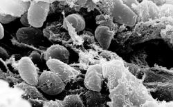 Wabah Pes Makan Korban di Mongolia, Penduduk Rusia di Perbatasan Minta Segera Divaksin