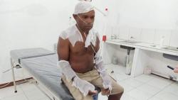 Gereja di Dekai Yakuhimo Terbakar, Seorang Pendeta Luka-Luka