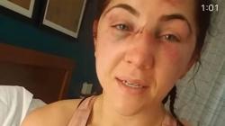 H-3 Minggu Menikah, Petarung UFC Cantik Ini Bonyok Dihajar Lawan