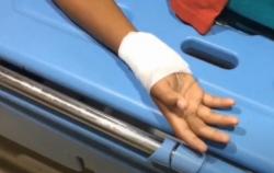 Video Bocah 12 Tahun di Bekasi Dibacok Orang Tak Dikenal, Tangan Nyaris Putus