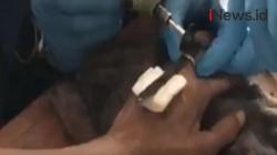 Video Petugas Damkar Bantu Lepas Belasan Cincin dari Jari Tangan Lansia