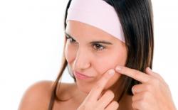 4 Cara Menghilangkan Bekas Jerawat Membandel Dengan Buah-buahan