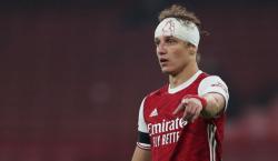 Cedera Kepala, David Luiz Absen di Liga Europa